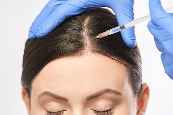 Combatting Hair Fall with PRP Therapy